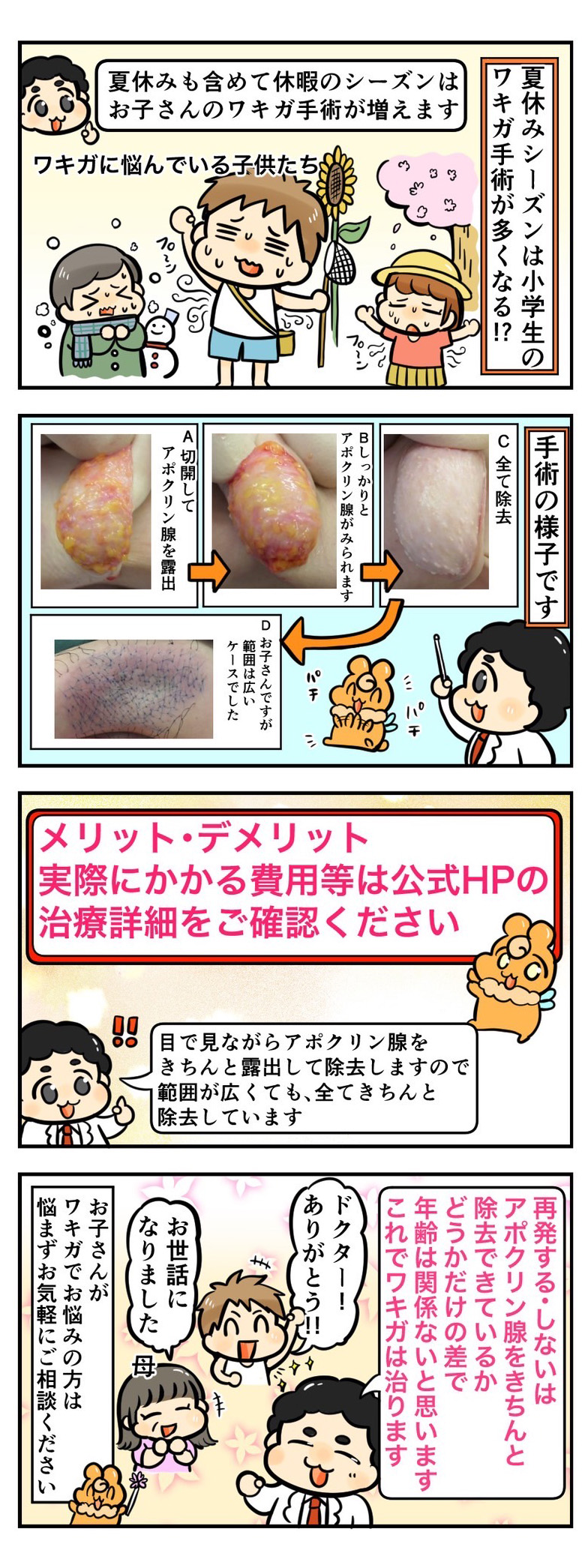 夏休みは小学生のワキガ手術が多くなる！？
