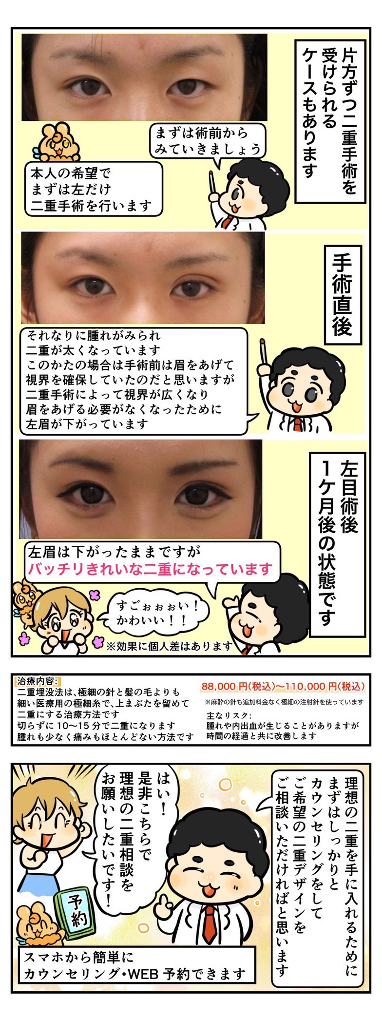 片方ずつ二重手術を受けられたケース
