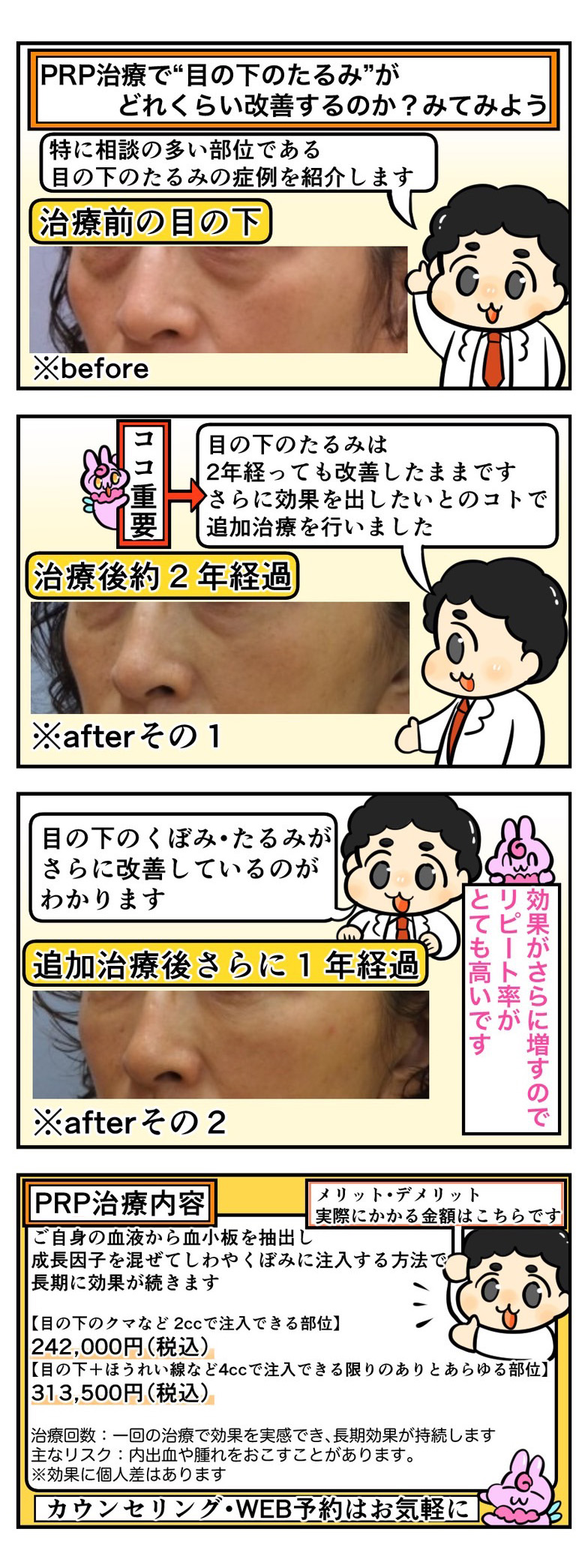 PRPで“目の下のたるみ”はどれくらい改善する？