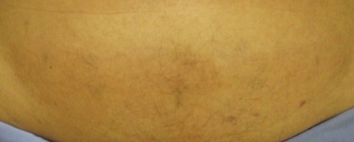 美容と健康の魔法の杖-ゼルティック翌日